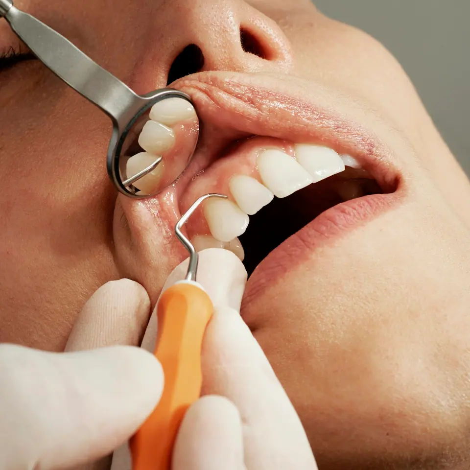 Dental Cleaning & Checkup