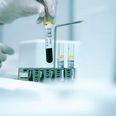 Flat ₹420 off on Full Body Health Checkup (80 tests)